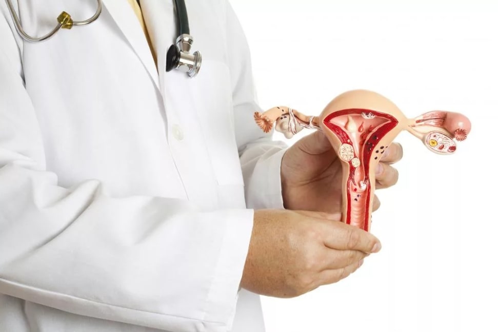 임신 착상혈 관련 의사가 자궁 모형을 들고 있는 모습