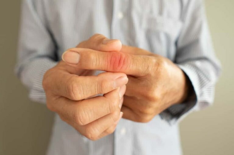 방아쇠수지증후군 관련 검지 손가락 부분이 빨갛게 되어 있고 해당 부분을 반대쪽 손으로 잡고 있는 모습