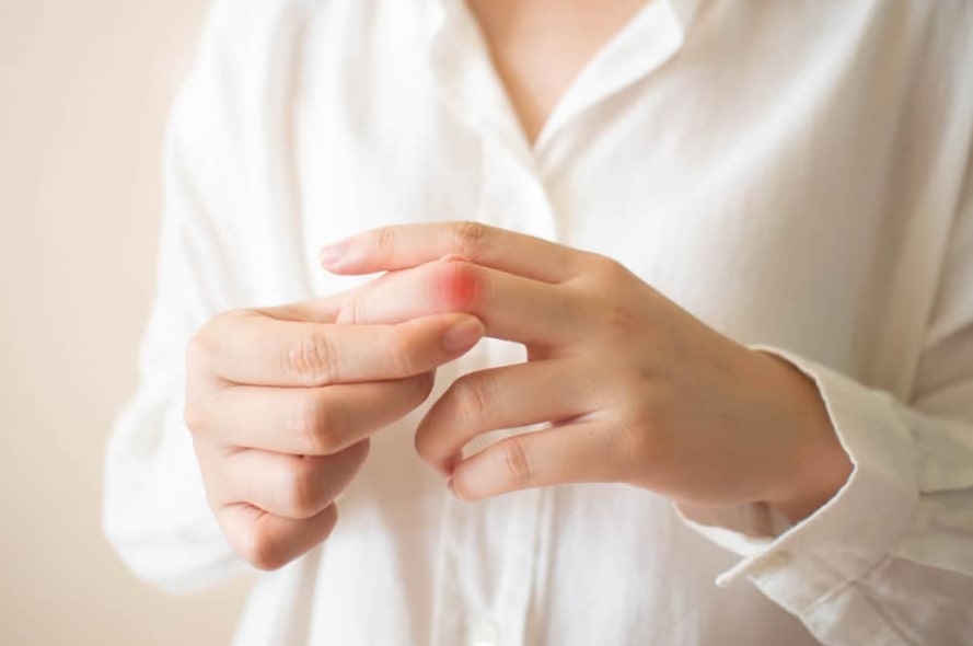 방아쇠수지증후군 관련 왼쪽 세번째 손가락 부근이 빨갛게 되어 있고 반대쪽 손으로 해당 손가락을 잡고 있는 모습