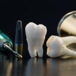 치아 발치 후 임플란트 관련 임플란트와 치아 모형이 나란히 놓여진 모습
