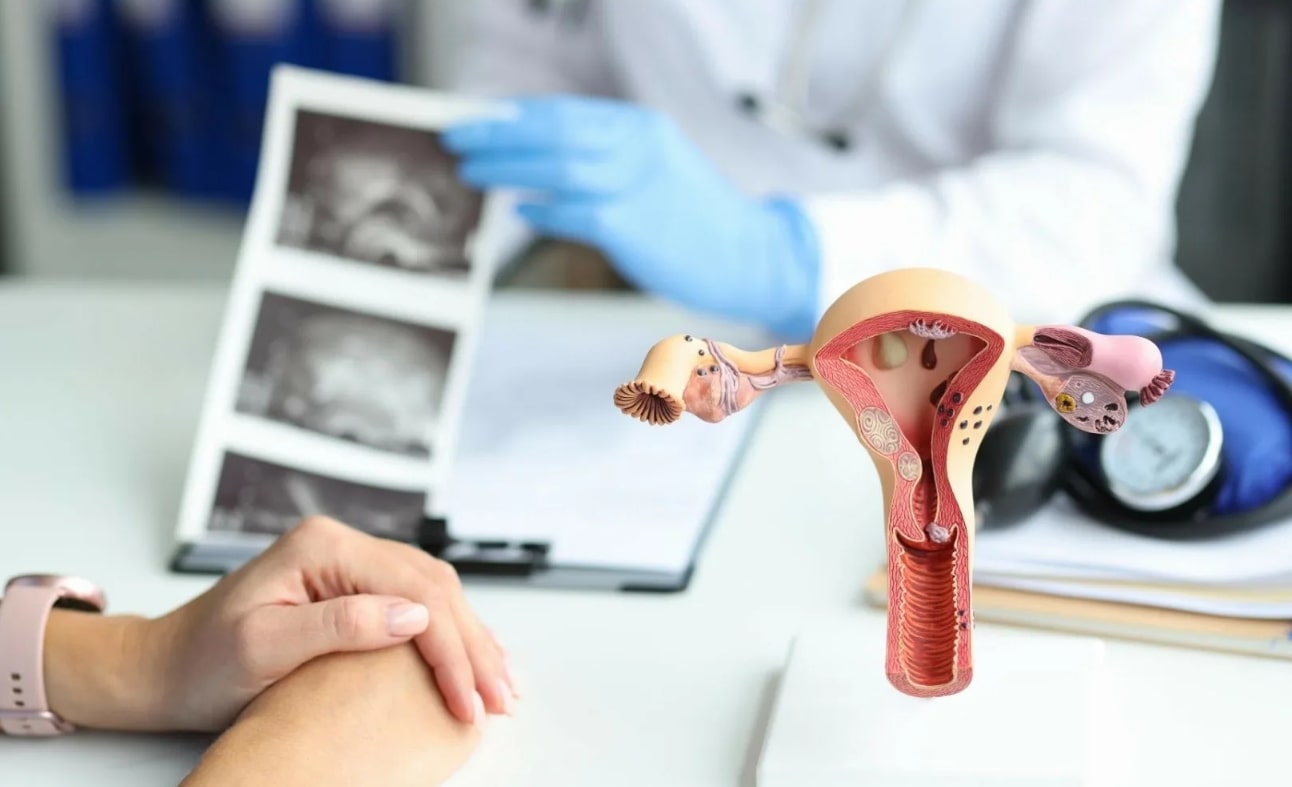 생리전 미열 관련 병원에서 의사가 무언가를 설명하고 있고 책상 위에 자궁 모형이 놓여진 모습
